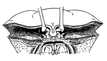 Uca coarctata flammula thumbnail