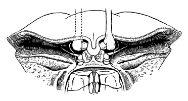 Uca forcipata thumbnail
