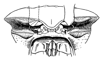 Uca inaequalis thumbnail
